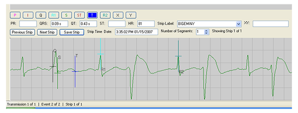 Kakadu Scheiding haag Event Loop Recorder - LX Event | NorthEast Monitoring